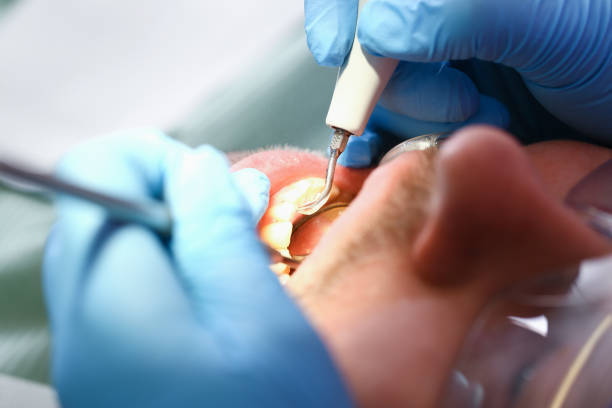 Best Tooth Infection Emergency Dentist  in Piketon, OH