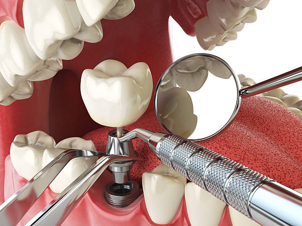 Best Tooth Pain Emergency Relief  in Piketon, OH
