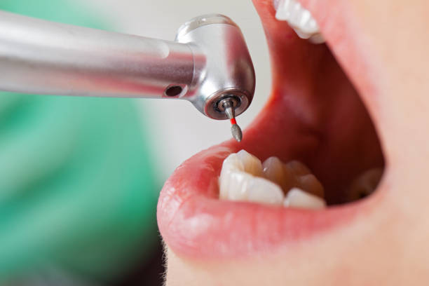 Best Emergency Tooth Extraction  in Piketon, OH
